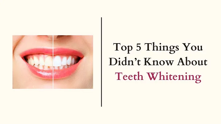 5 Things You Didn’t Know About Teeth Whitening