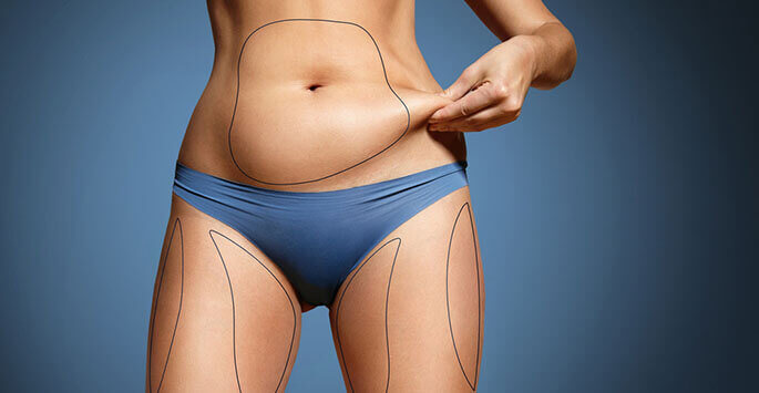 Modern surgical facility for liposuction treatment at NV Aesthetics Mansarovar Jaipur